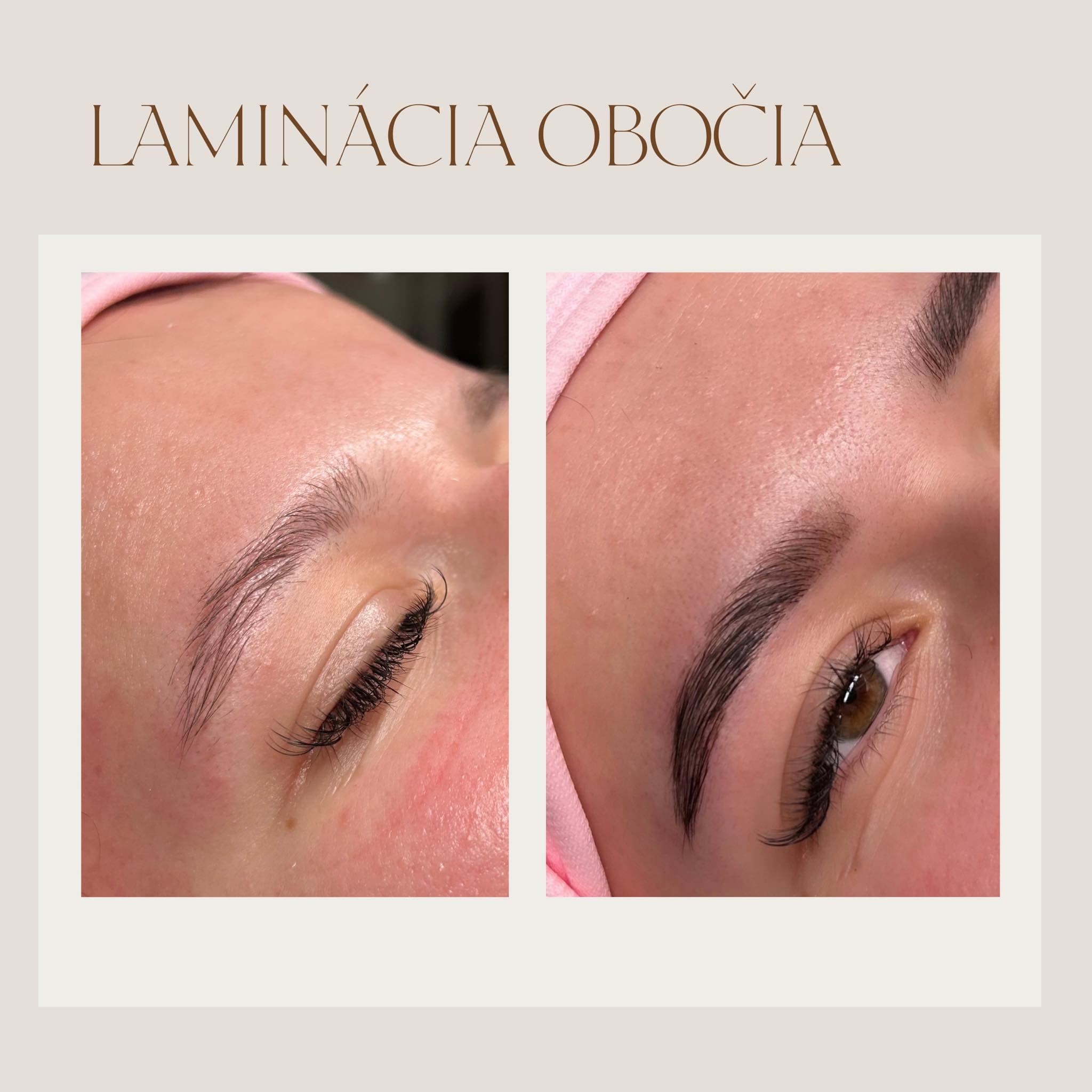 Laminácia obočia a mihalníc